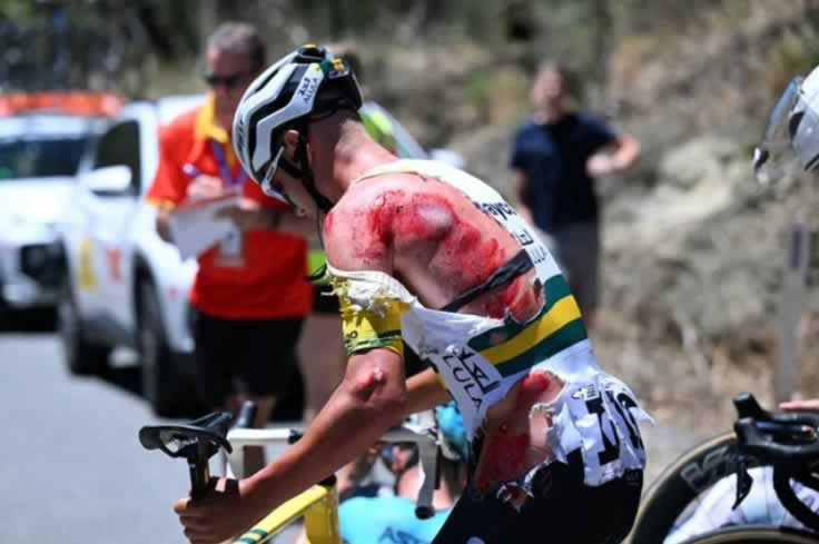 Люк Плапп (Jayco-AlUla) получил много дорожной сыпи после аварии на третьем этапе Tour Down Under